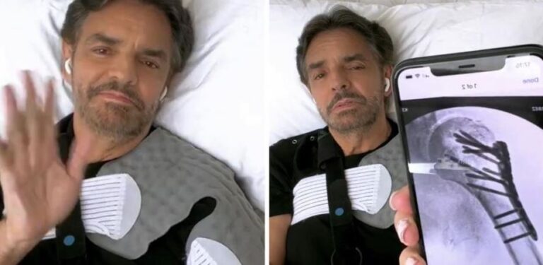 DERBEZ 2