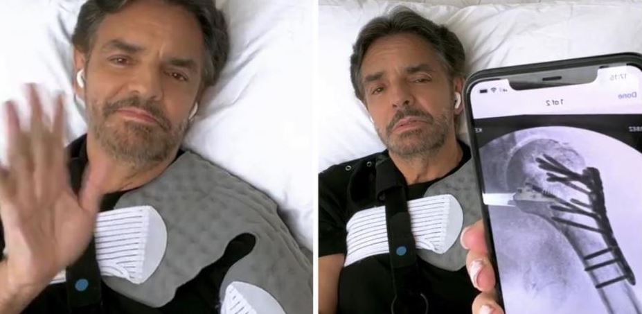 DERBEZ 2